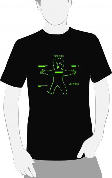 Vault Boy - Crippled Limbs